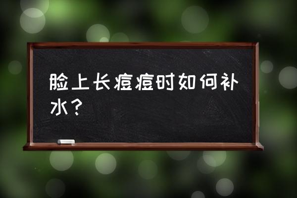 痘痘肌的好习惯 脸上长痘痘时如何补水？