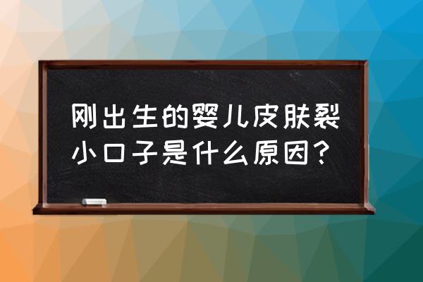 小孩皮肤皲裂怎么快速恢复 刚出生的婴儿皮肤裂小口子是什么原因？