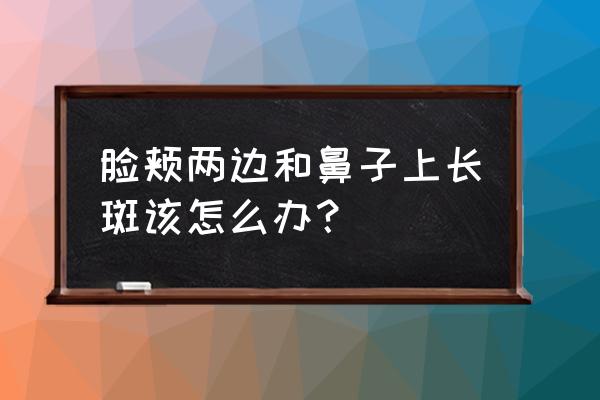 男的鼻子上有黑斑点怎么去除 脸颊两边和鼻子上长斑该怎么办？