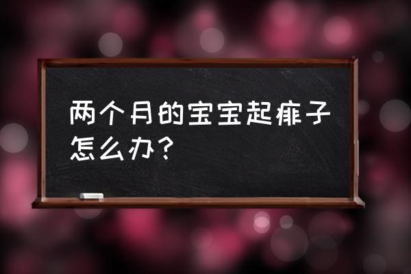 痱子怎么快速去除小窍门 两个月的宝宝起痱子怎么办？